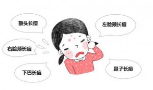 脸上频繁爆青春痘是怎么回事