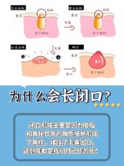 经常长痤疮是什么原因