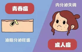 痘痘的临床表现有哪些