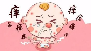 得了湿疹怎么治疗好