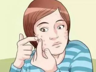青春痘的形成是什么原因